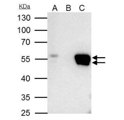 Immunoprecipitation: FLI1 Antibody [NBP2-16500]