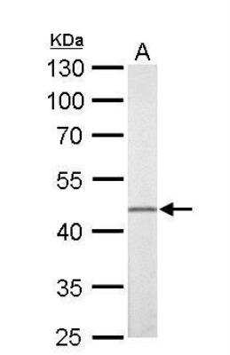 Western Blot: FLI1 Antibody [NBP2-16500]