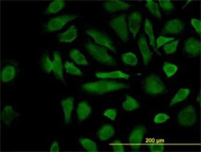 Immunocytochemistry/ Immunofluorescence: FLIP Antibody (2F12) [H00008837-M01]