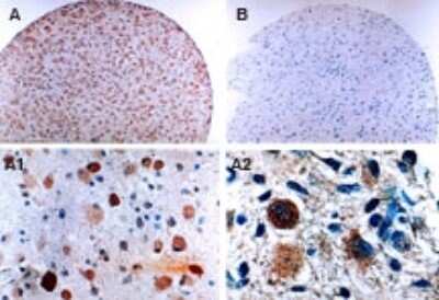 Immunohistochemistry: FLIP Antibody [NB100-56141]
