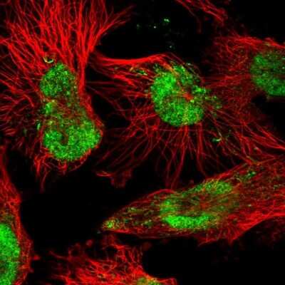 Immunocytochemistry/ Immunofluorescence: FLJ10154 Antibody [NBP2-58390]