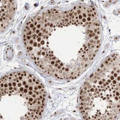 Immunohistochemistry-Paraffin: FLJ10154 Antibody [NBP1-87921]