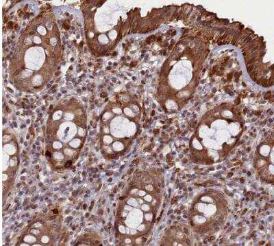 Immunohistochemistry-Paraffin: FLJ10815 Antibody [NBP1-87910]