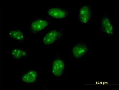 Immunocytochemistry/ Immunofluorescence: FLJ11184 Antibody [H00055319-B01P]
