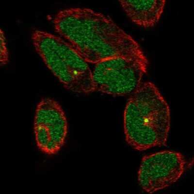 Immunocytochemistry/ Immunofluorescence: FLJ13946 Antibody [NBP2-46792]