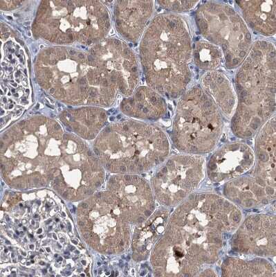 Immunohistochemistry-Paraffin: FLJ14154 Antibody [NBP1-91904]