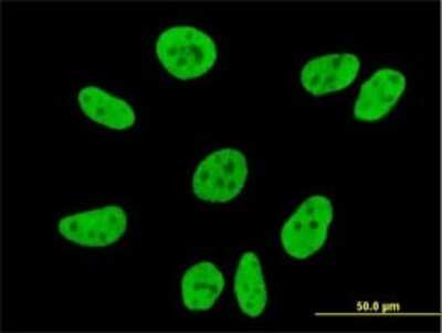 Immunocytochemistry/ Immunofluorescence: VPS50 Antibody (2D11) [H00055610-M01]