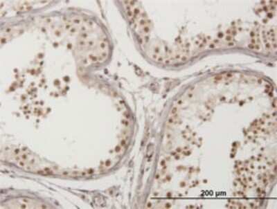 Immunohistochemistry-Paraffin: VPS50 Antibody (2D11) [H00055610-M01]