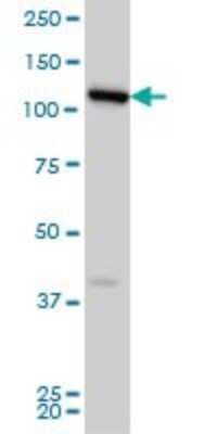 Western Blot: VPS50 Antibody (2D11) [H00055610-M01]