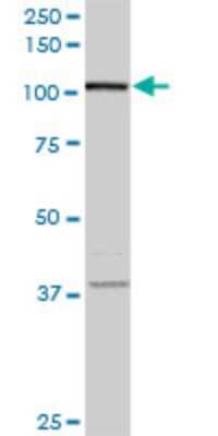 Western Blot: VPS50 Antibody (2D11) [H00055610-M01]