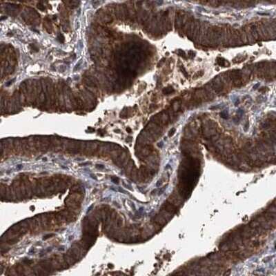 Immunohistochemistry-Paraffin: FLJ21908 Antibody [NBP1-89850]