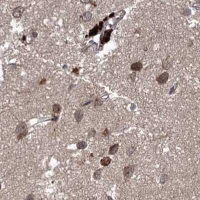 Immunohistochemistry-Paraffin: FLJ21908 Antibody [NBP1-89850]