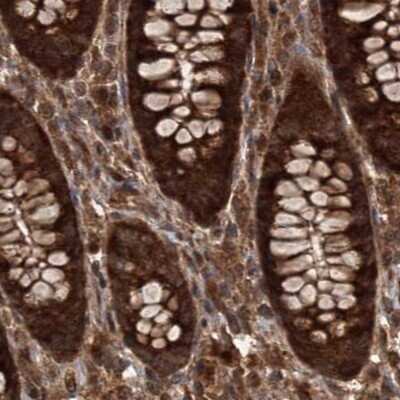 Immunohistochemistry-Paraffin: FLJ21908 Antibody [NBP1-89850]