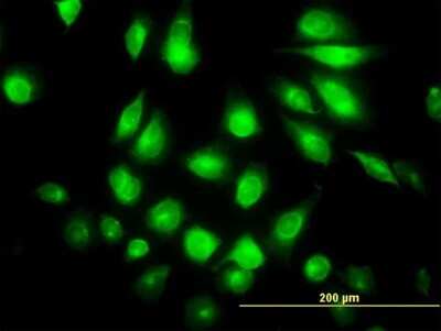 Immunocytochemistry/ Immunofluorescence: POMK/SGK196 Antibody (6F10) [H00084197-M03]
