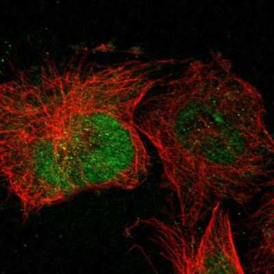 Immunocytochemistry/ Immunofluorescence: POMK/SGK196 Antibody [NBP2-13302]