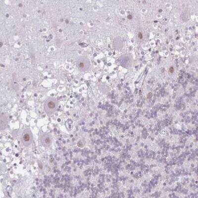 Immunohistochemistry: FLJ23584 Antibody [NBP2-31018]