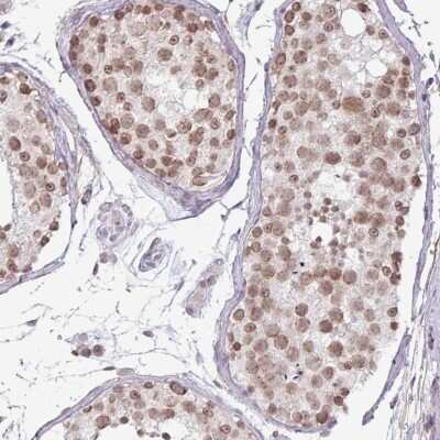 Immunohistochemistry-Paraffin: FLJ23584 Antibody [NBP2-31018]