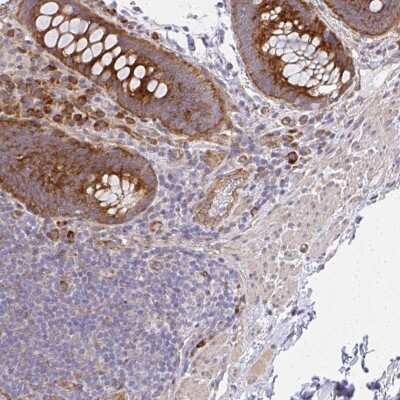 Immunohistochemistry: FLJ25006 Antibody [NBP2-47455]