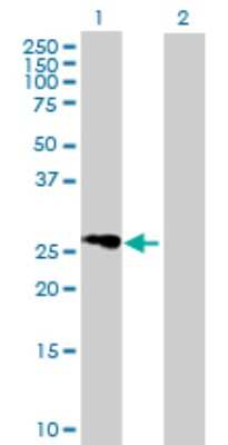 Western Blot: FLJ25006 Antibody [H00124923-B01P]