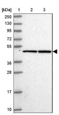 Western Blot: FLJ25006 Antibody [NBP2-47455]