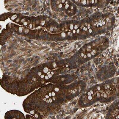 Immunohistochemistry-Paraffin: FLJ37078 Antibody [NBP1-91906]