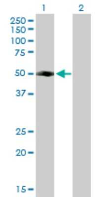 Western Blot: FLJ46536 Antibody [H00285180-B01P]