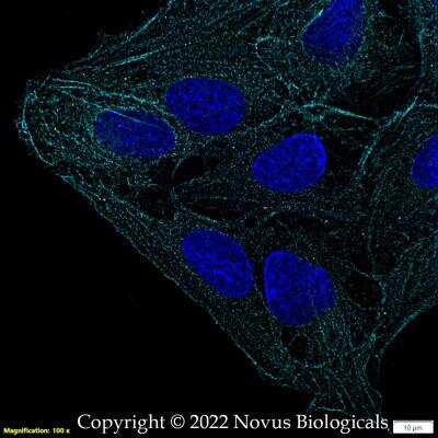 Immunocytochemistry/ Immunofluorescence: FLNC Antibody - BSA Free [NBP2-79816]