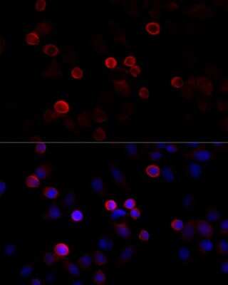 Immunocytochemistry/ Immunofluorescence: FLNC Antibody - Azide and BSA Free [NBP3-04857]