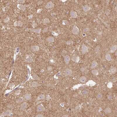 Immunohistochemistry: FLRT1 Antibody [NBP2-49139]