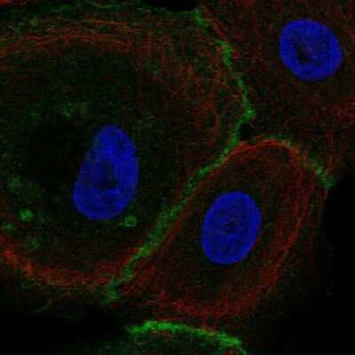 Immunocytochemistry/ Immunofluorescence: FLRT3 Antibody [NBP2-38778]
