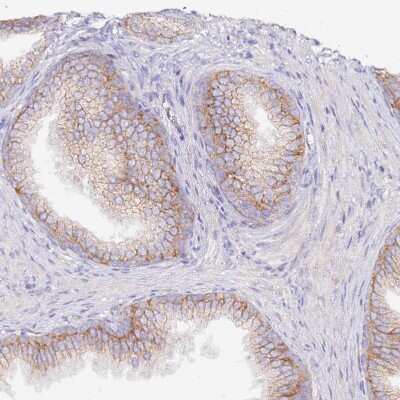 Immunohistochemistry-Paraffin: FLVCR Antibody [NBP2-14019]