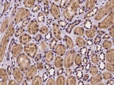 Immunohistochemistry-Paraffin: FLVCR Antibody [NBP2-97925]