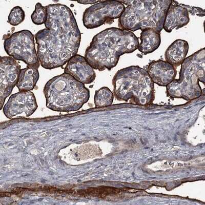 Immunohistochemistry-Paraffin: FLVCR2 Antibody [NBP1-94146]