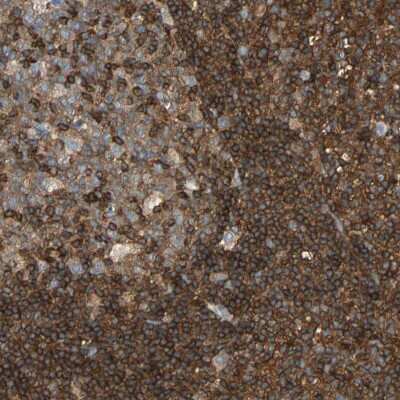 Immunohistochemistry-Paraffin: FMNL1 Antibody [NBP1-88460]