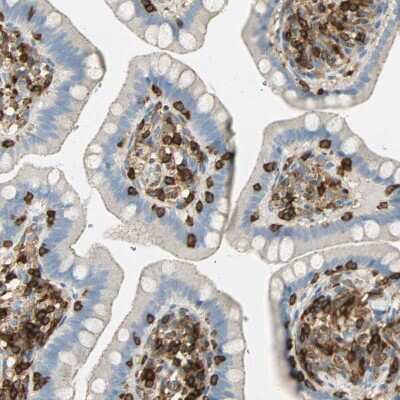 Immunohistochemistry-Paraffin: FMNL1 Antibody [NBP1-88460]