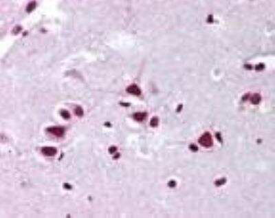 Immunohistochemistry-Paraffin: FMNL2 Antibody [NBP2-24748]