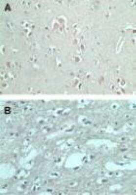 Immunohistochemistry-Paraffin: FMNL2 Antibody [NBP2-24748]