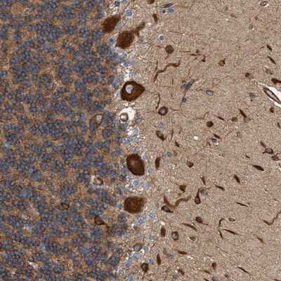 Immunohistochemistry-Paraffin: FMNL3 Antibody [NBP1-84091]
