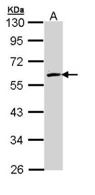 Western Blot: FMO2 Antibody [NBP1-33318]