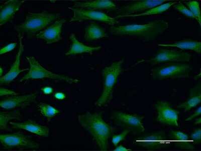 Immunocytochemistry/ Immunofluorescence: FMO3 Antibody [H00002328-B01P]