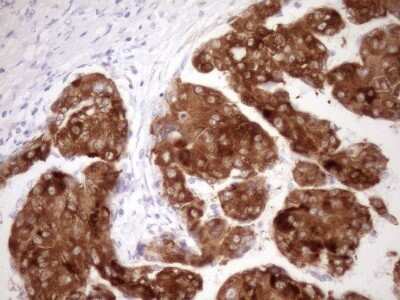 Immunohistochemistry: FMO3 Antibody (OTI3H1) - Azide and BSA Free [NBP2-70755]