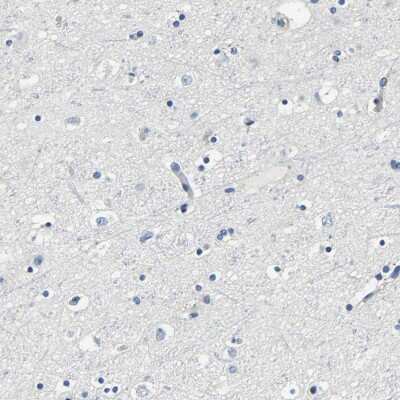 Immunohistochemistry-Paraffin: FMO5 Antibody [NBP1-86093]