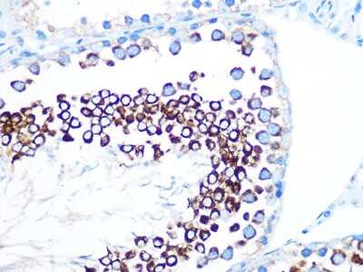 Immunohistochemistry-Paraffin: FMRP Antibody (4Y8I5) [NBP3-16431]