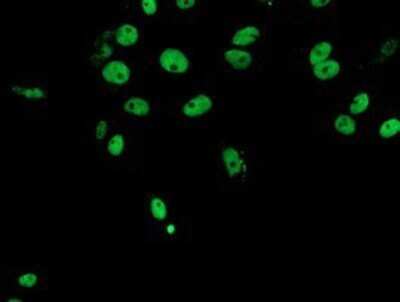 Immunocytochemistry/ Immunofluorescence: FMRP Antibody (OTI1C6) - Azide and BSA Free [NBP2-70756]