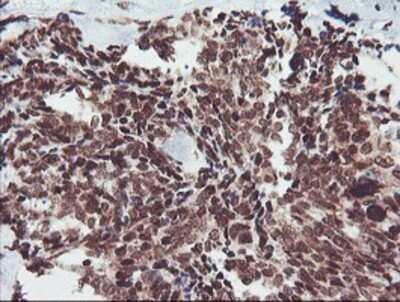 Immunohistochemistry: FMRP Antibody (OTI1C6) - Azide and BSA Free [NBP2-70756]