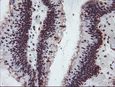 Immunohistochemistry: FMRP Antibody (OTI1C6) - Azide and BSA Free [NBP2-70756]