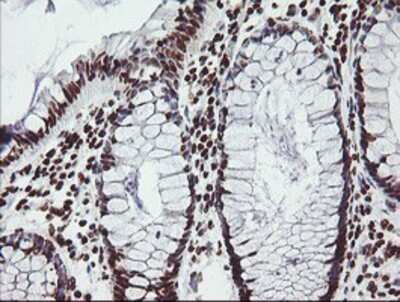 Immunohistochemistry: FMRP Antibody (OTI1C6) - Azide and BSA Free [NBP2-70756]