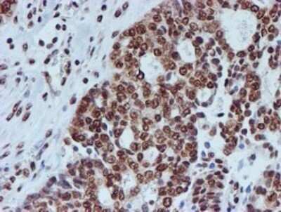 Immunohistochemistry: FMRP Antibody (OTI3B4) - Azide and BSA Free [NBP2-70761]