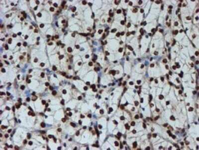 Immunohistochemistry: FMRP Antibody (OTI3B4) - Azide and BSA Free [NBP2-70761]