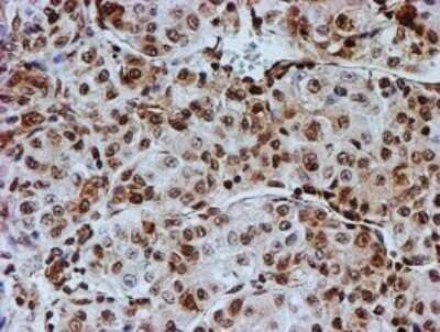 Immunohistochemistry: FMRP Antibody (OTI3B4) - Azide and BSA Free [NBP2-70761]